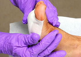 Wound Care