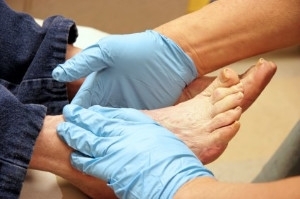 Symptoms of Diabetic Feet